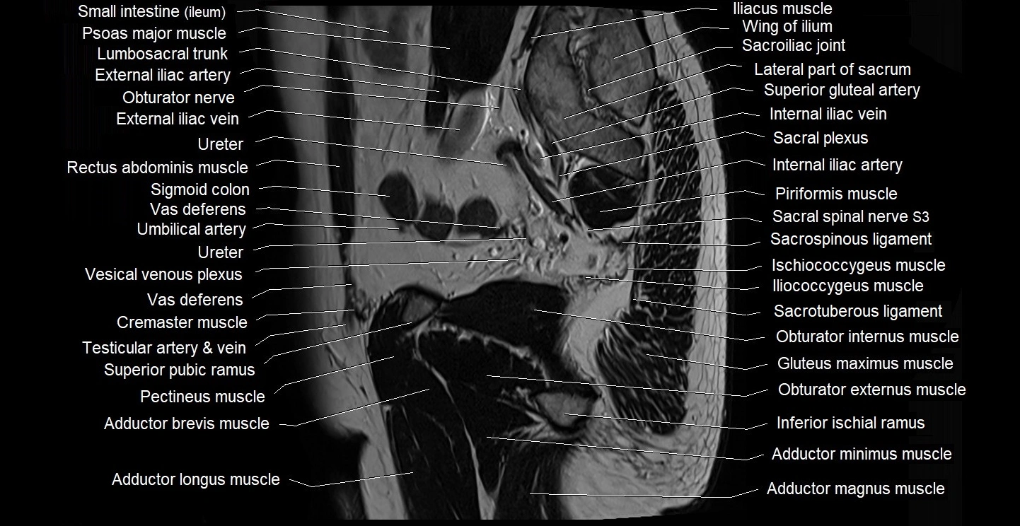 male pelvis sagittal cross sectional anatomy 3T mri image 12.webp